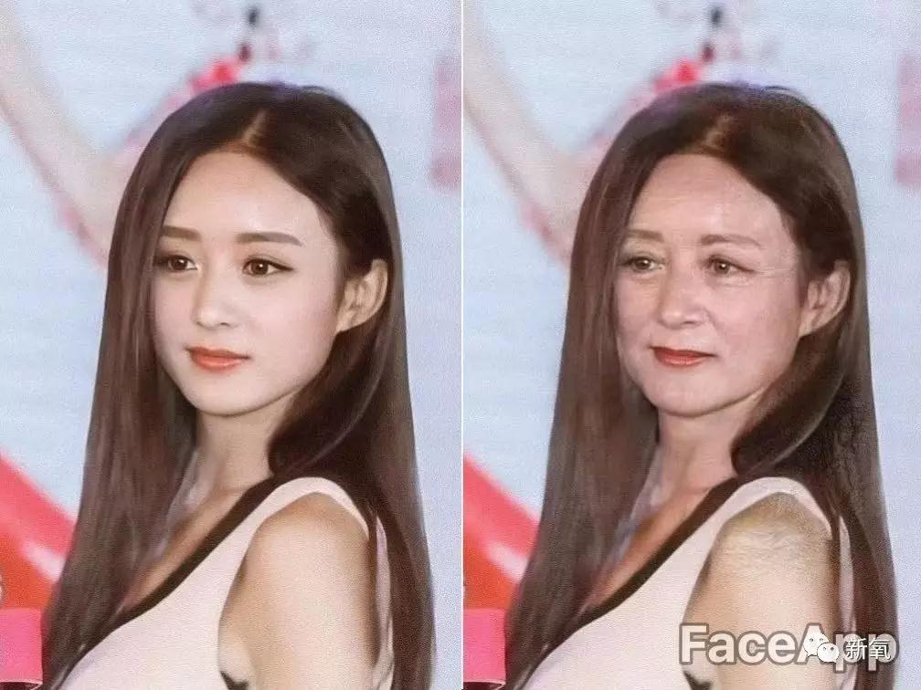 前沿拓展:成都鼻唇沟整形多少钱